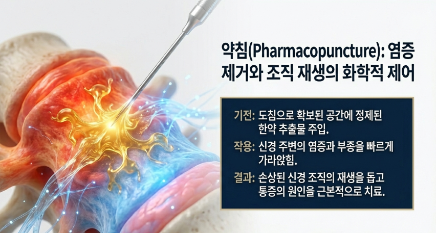 길음역 한의원의 척추관협착증 기능 개선 지수(ODI) 변화 그래프