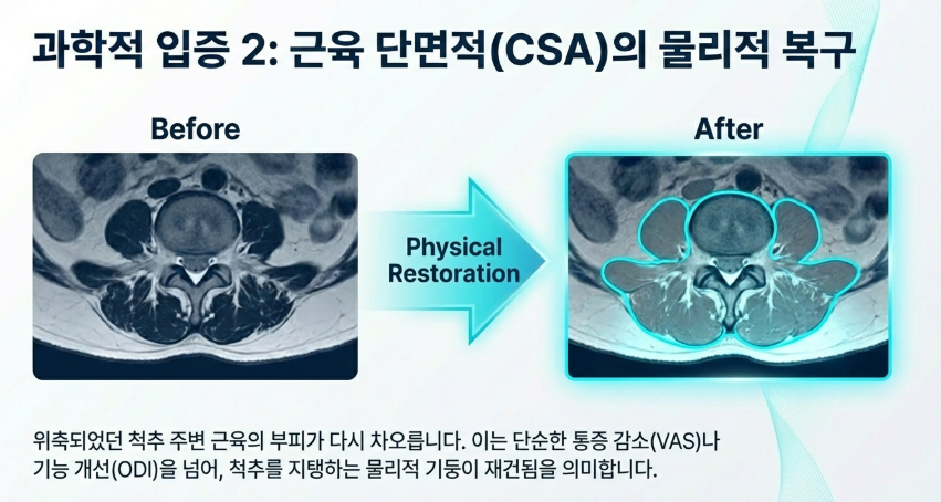2024년 연구 데이터 기반 침 치료 전후 척추 근육 내 지방 함량 변화 비교
