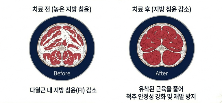성북구 도침치료 시 초음파 가이드를 통해 신경과 혈관을 확인하는 정밀 시술 장면