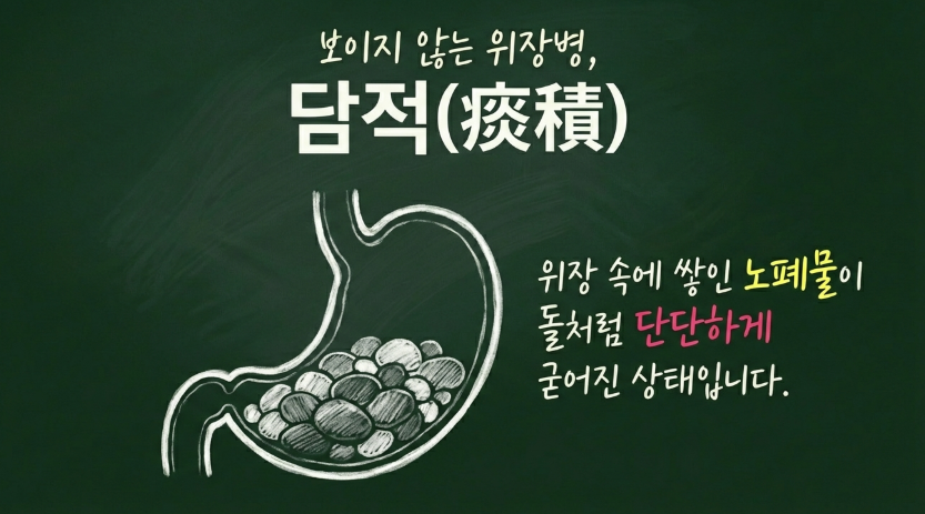 2023년 최신 논문 기반 담적 증상의 5가지 핵심 진단 요소 인포그래픽