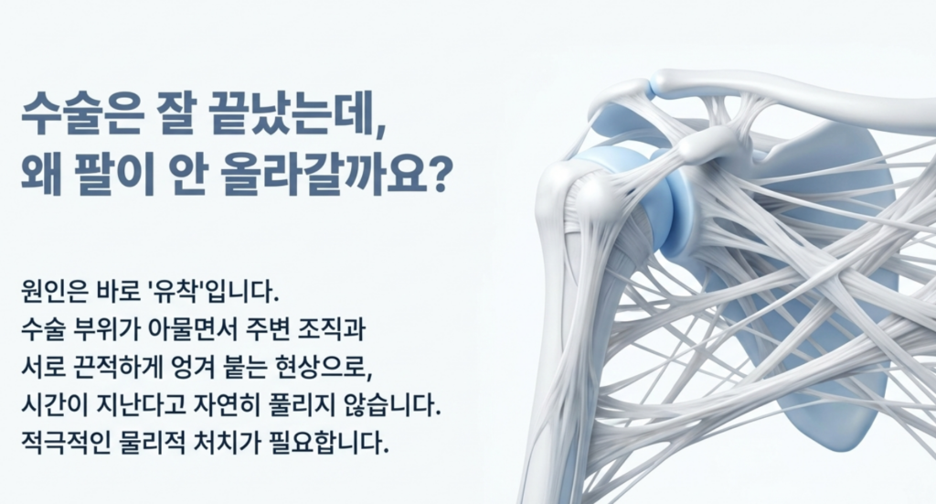 길음역 한의원에서 시행하는 초음파 가이드 도침 시술을 통한 어깨 관절 내 유착 박리 장면