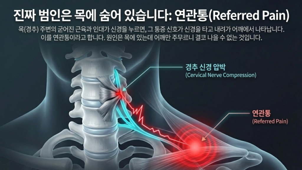 길음역 한의원 추천 검색 시 확인해야 할 승모근 뭉침과 목 신경 눌림의 상관관계 모식도