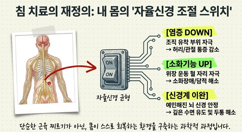 길음동 침 잘 놓는 한의원에서 시행하는 허리통증 및 소화불량 개선을 위한 세밀한 침 치료 과정
