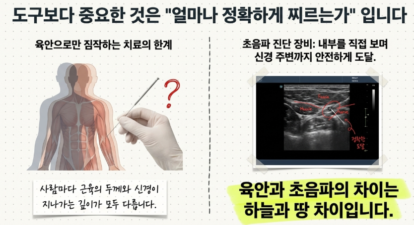 초음파 기기로 요추 45번 디스크 부위의 깊이와 신경 위치를 실시간으로 확인하는 검사 장면