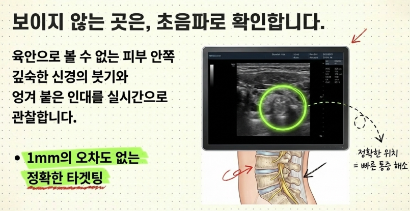 초음파로 부어있는 신경 위치를 확인하여 허리 통증을 효과적으로 치료하는 방법