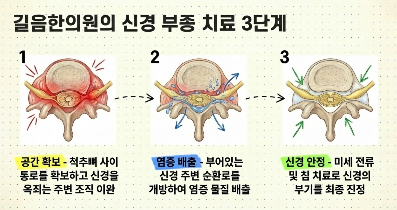 초음파로 부어있는 신경 위치를 확인하여 허리 통증을 효과적으로 치료하는 방법