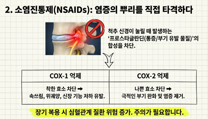 소염진통제인 NSAIDs가 위점막을 보호하는 COX-1 효소까지 억제하여 속쓰림을 유발하는 과정