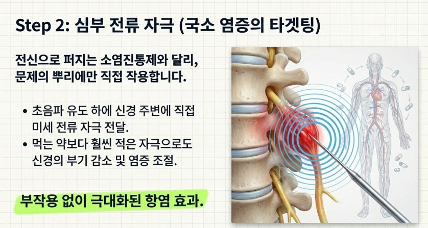 진통제 복용량을 줄이고 척추 자생력을 높이기 위해 시행하는 체계적인 기능 회복 운동