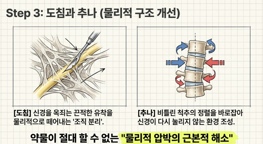 진통제 복용량을 줄이고 척추 자생력을 높이기 위해 시행하는 체계적인 기능 회복 운동