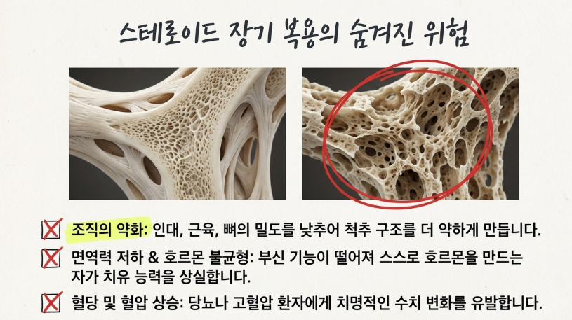 종암동 한의원 환자들이 겪는 신경 염증과 스테로이드가 신체 호르몬 체계에 미치는 영향