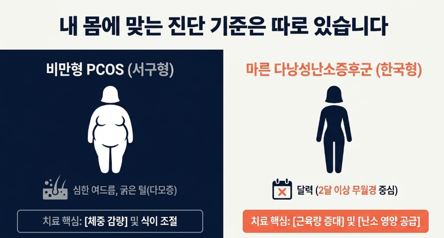 서구형 비만형인지 한국형 마른 다낭성난소증후군인지 진단 기준 도표 이미지