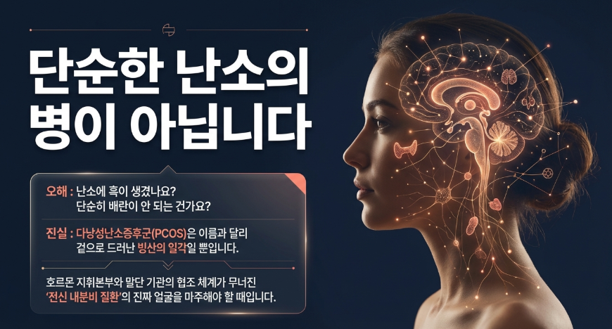 다낭성난소증후군 원인이 되는 시상하부-뇌하수체-난소 축의 호르몬 조절 기전