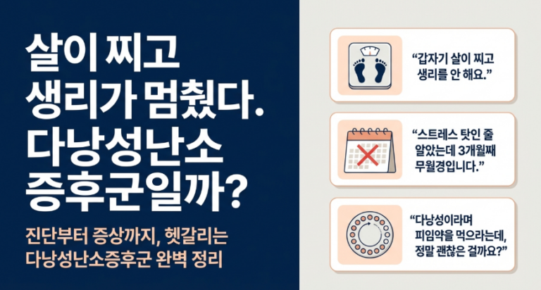 다낭성난소증후군 진단기준이 되는 3대 증상들
