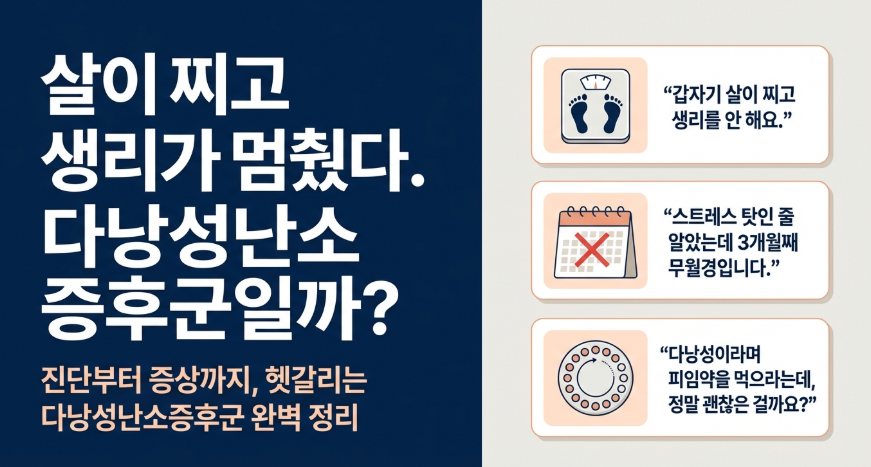 다낭성난소증후군 진단기준이 되는 3대 증상들