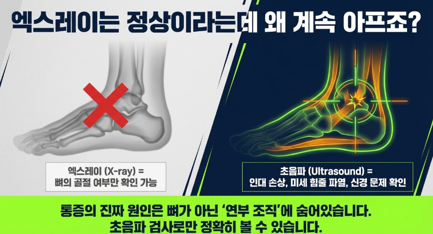 러닝 발목통증 왜 초음파 진료가 중요한지 설명하는 이미지 엑스레이와의 차이점