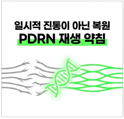 손목터널증후군 PDrn의 재생효과