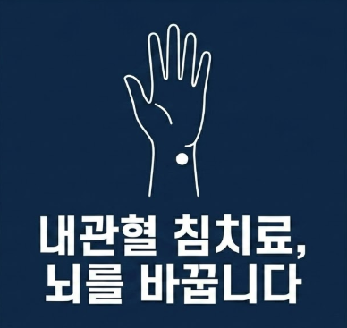 불안장애 침치료에 효과적인 내관혈
