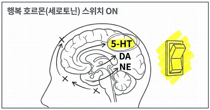 뇌졸중 후 우울증 침치료가 세로토닌을 올리는 기전
