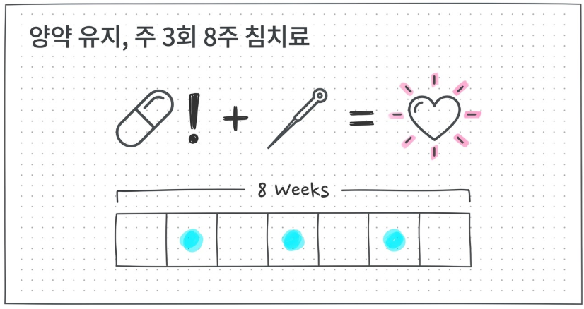 뇌졸중 후 우울증 침치료는 주3회 8주 치료가 좋다는 연구 이미지